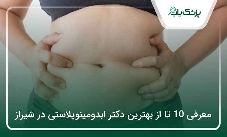 بهترین دکتر ابدومینوپلاستی در شیراز