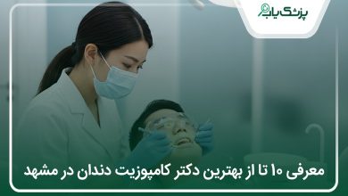 بهترین دکتر کامپوزیت دندان در مشهد