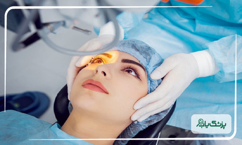 بهترین جراح عمل چشم (لازک) در اصفهان را چطور انتخاب کنیم؟