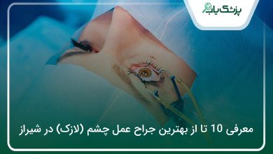 بهترین جراح عمل چشم (لازک) در شیراز