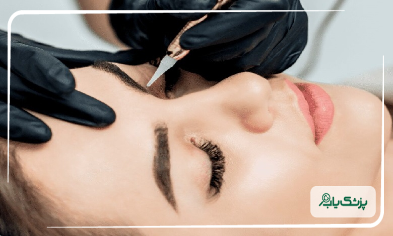نتیجه نهایی کاشت ابرو بعد از چند ماه مشخص میشود؟