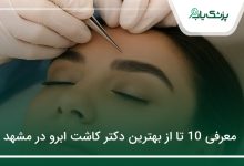 بهترین دکتر کاشت ابرو در مشهد