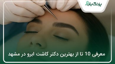 بهترین دکتر کاشت ابرو در مشهد