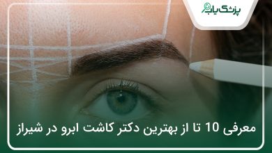 بهترین دکتر کاشت ابرو در شیراز