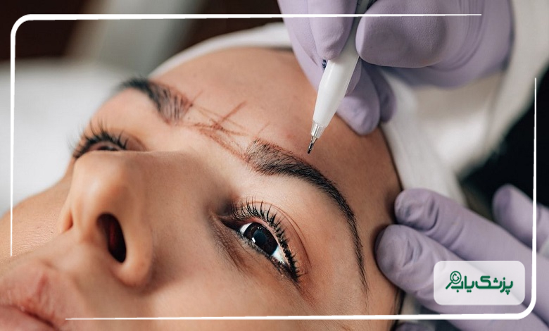 کاشت ابرو برای چه کسانی مناسب است؟