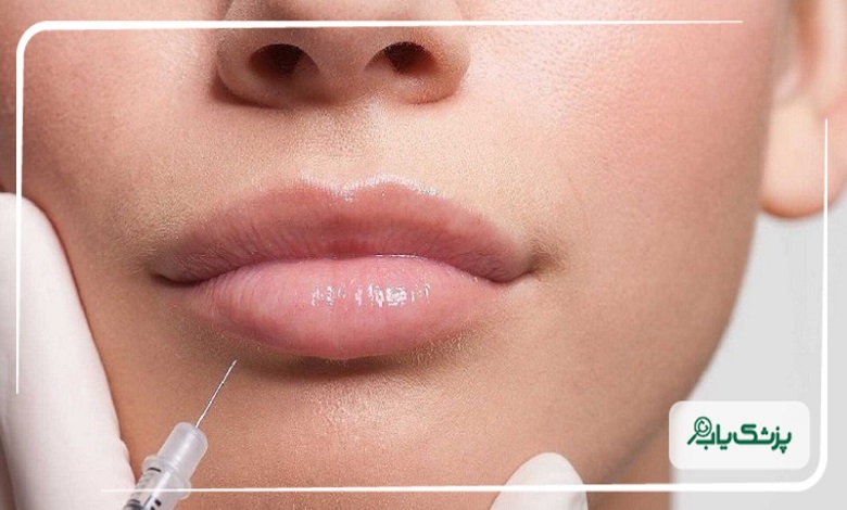 مراقبت های مهم قبل و بعد از تزریق ژل