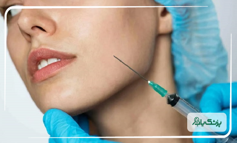 نکات مراقبتی بعد از انجام تزریق ژل