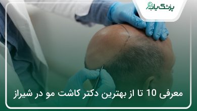 بهترین دکتر کاشت مو در شیراز