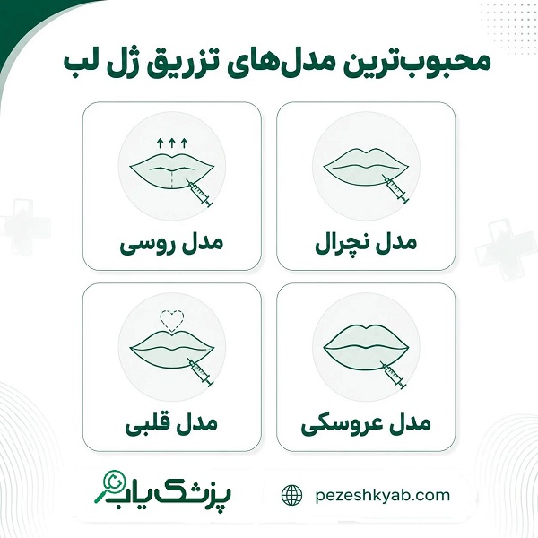 محبوب ترین مدل های تزریق ژل لب