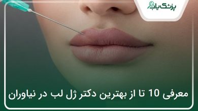 بهترین دکتر ژل لب در نیاوران