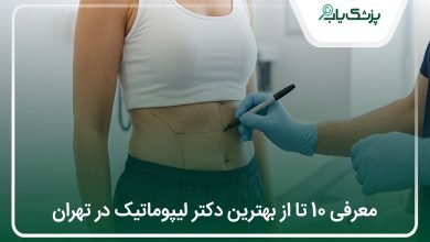 بهترین دکتر لیپوماتیک در تهران