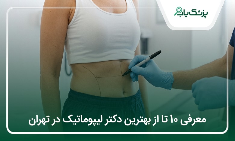 بهترین دکتر لیپوماتیک در تهران