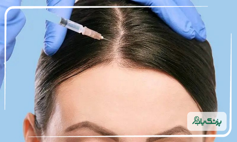 مزوتراپی برای چه کسانی مناسب است؟