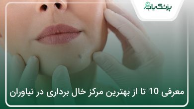 بهترین مرکز خال برداری در نیاوران