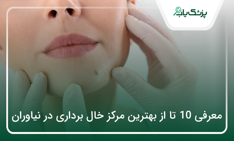 بهترین مرکز خال برداری در نیاوران