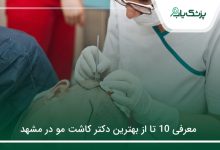 بهترین دکتر کاشت مو در مشهد
