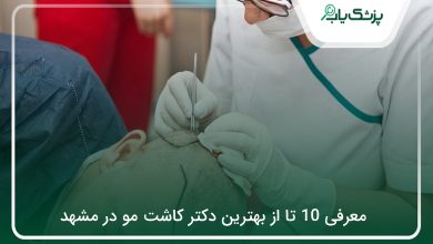 بهترین دکتر کاشت مو در مشهد