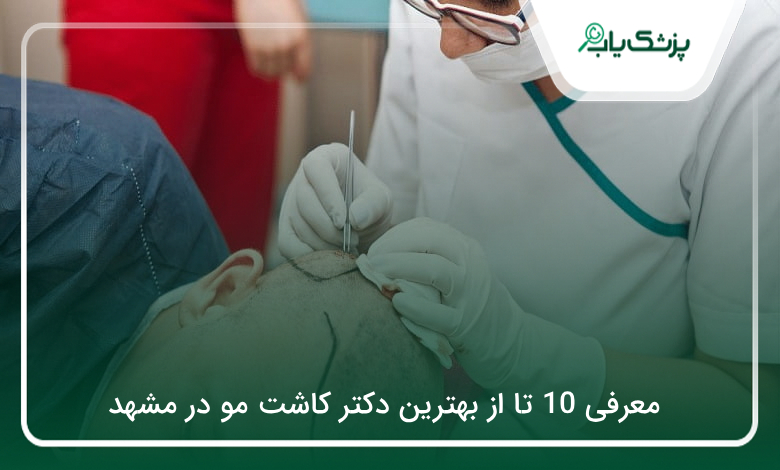 بهترین دکتر کاشت مو در مشهد