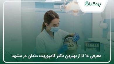 بهترین دکتر کامپوزیت دندان در مشهد