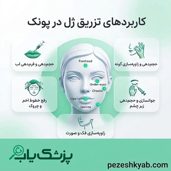 کاربردهای تزریق ژل در پونک