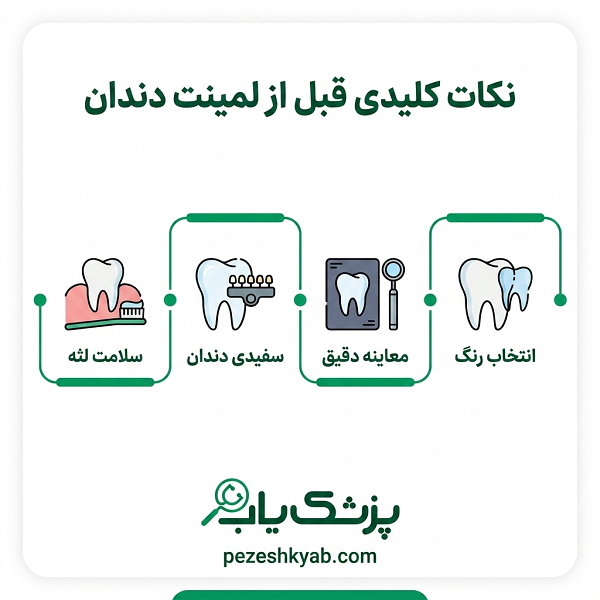 نکات کلیدی قبل از لمینت دندان