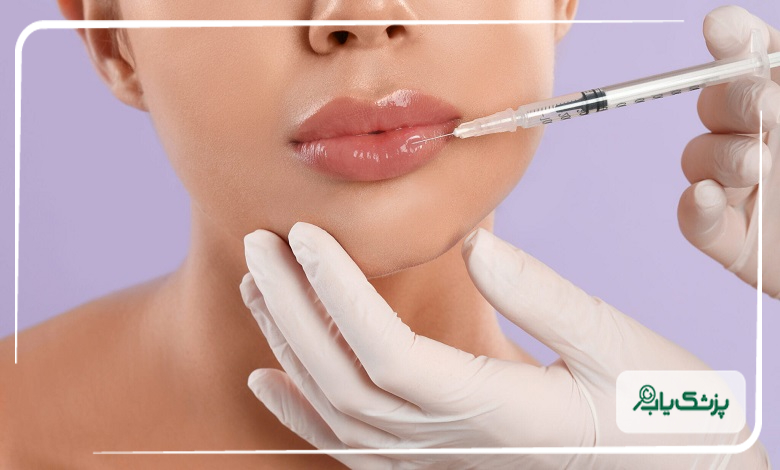 ماندگاری تزریق ژل لب چقدر است؟