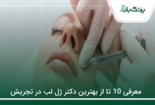 بهترین دکتر ژل لب در تجریش