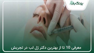 بهترین دکتر ژل لب در تجریش