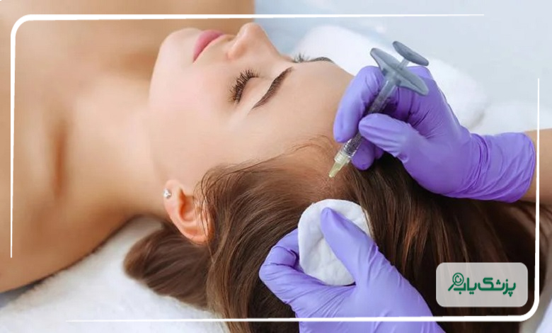 مزوتراپی صورت چگونه انجام میشود؟