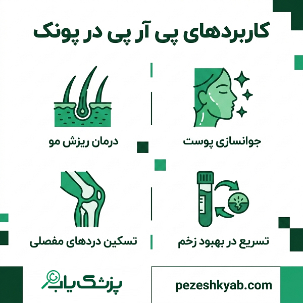 کاربردهای پی آر پی در پونک