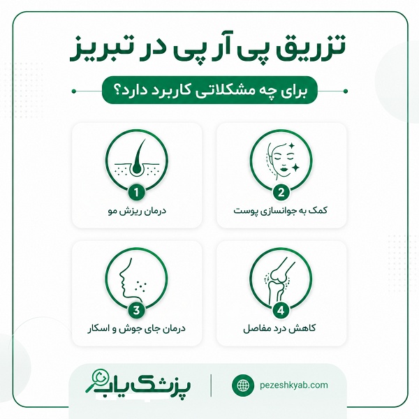 تزرزق پی آر پی در تبریز برای چه مشکلاتی کاربرد دارد؟