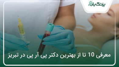 بهترین دکتر پی آر پی در تبریز