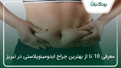 بهترین جراح ابدومینوپلاستی در تبریز