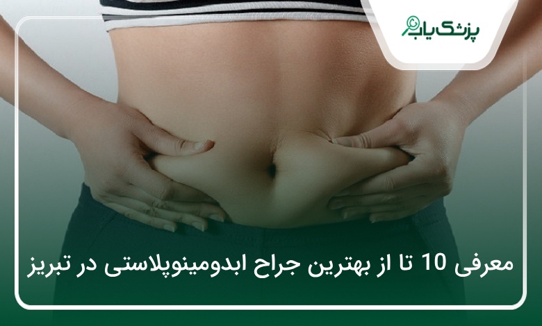 بهترین جراح ابدومینوپلاستی در تبریز