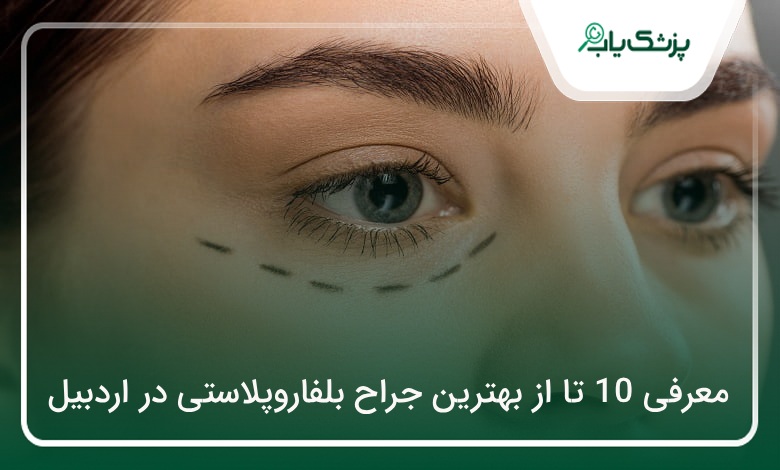 بهترین جراح بلفاروپلاستی در اردبیل