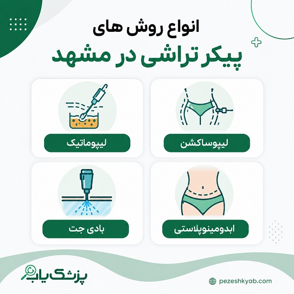 انواع روش های پیکر تراشی در مشهد