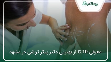 بهترین دکتر پیکر تراشی در مشهد