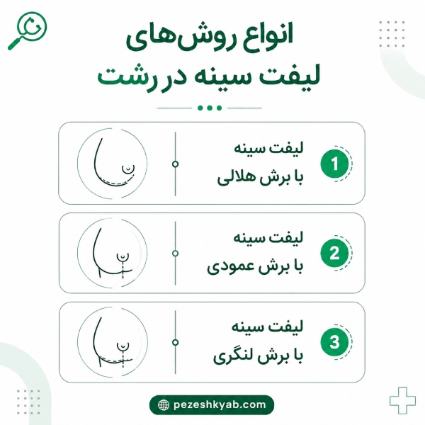 انواع روش های لیفت سینه در رشت
