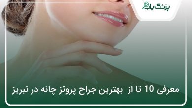 بهترین جراح پروتز چانه در تبریز