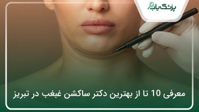 بهترین دکتر ساکشن غبغب در تبریز