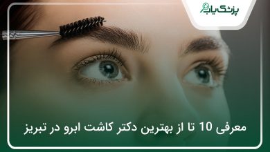 بهترین دکتر کاشت ابرو در تبریز