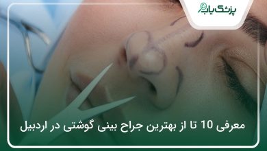 بهترین جراح بینی گوشتی در اردبیل