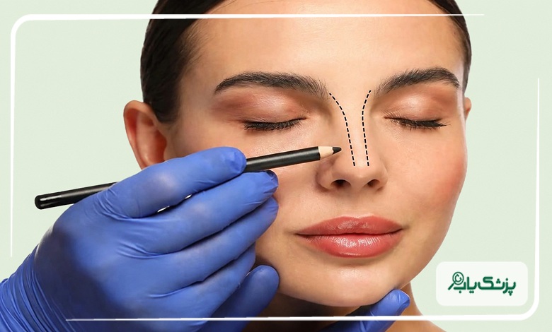 طراحی مدل بینی متناسب با چهره بیمار