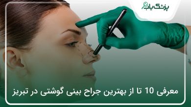 بهترین جراح بینی گوشتی در تبریز
