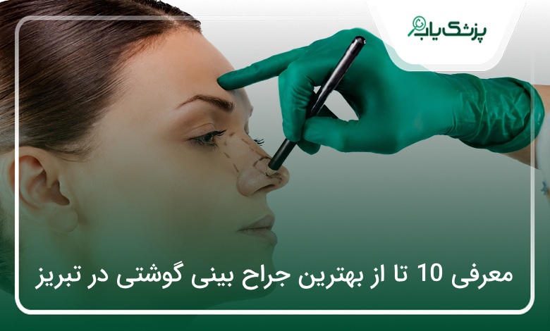 بهترین جراح بینی گوشتی در تبریز