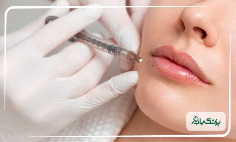 تزریق حرفهای ژل لب توسط بهترین دکتر در تبریز