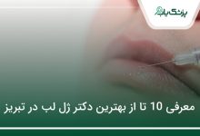بهترین دکتر ژل لب در تبریز