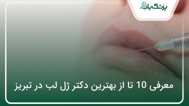 بهترین دکتر ژل لب در تبریز