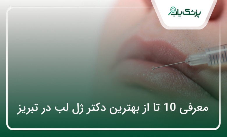 بهترین دکتر ژل لب در تبریز
