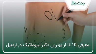 بهترین دکتر لیپوماتیک در اردبیل